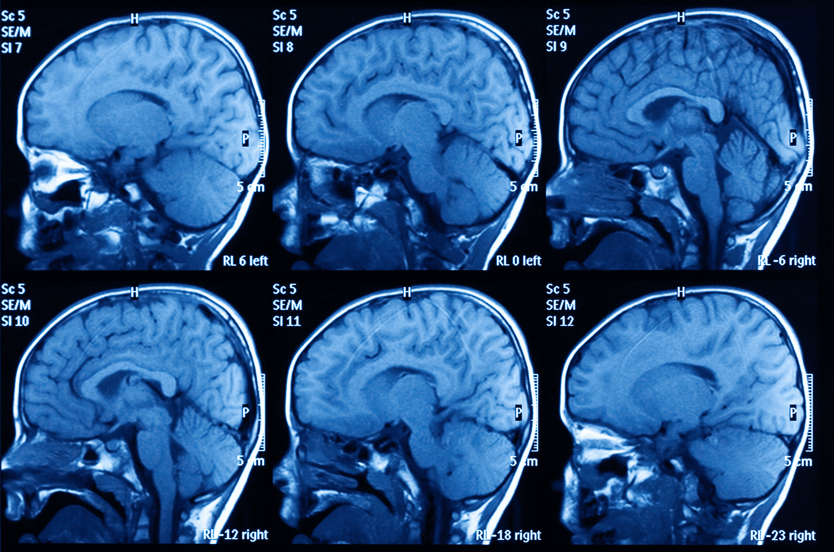 Brain Scans
